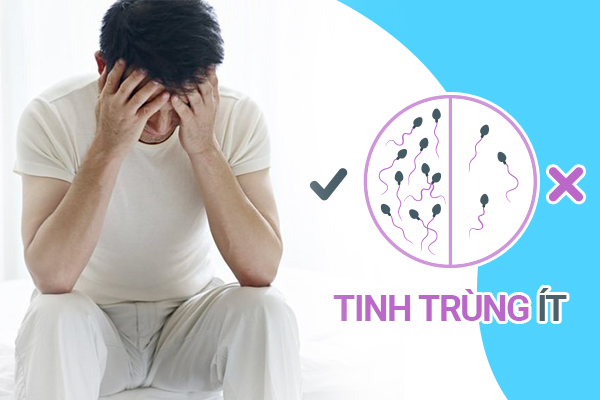 Tinh trùng ít: Nguyên nhân và cách khắc phục